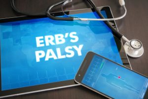 What causes Erb's Palsy?