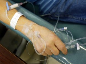 Beldock and Saunders injury lawyers New York Physician’s failure to diagnose early-stage rectal cancer resulting in death of a 65-year-old man.